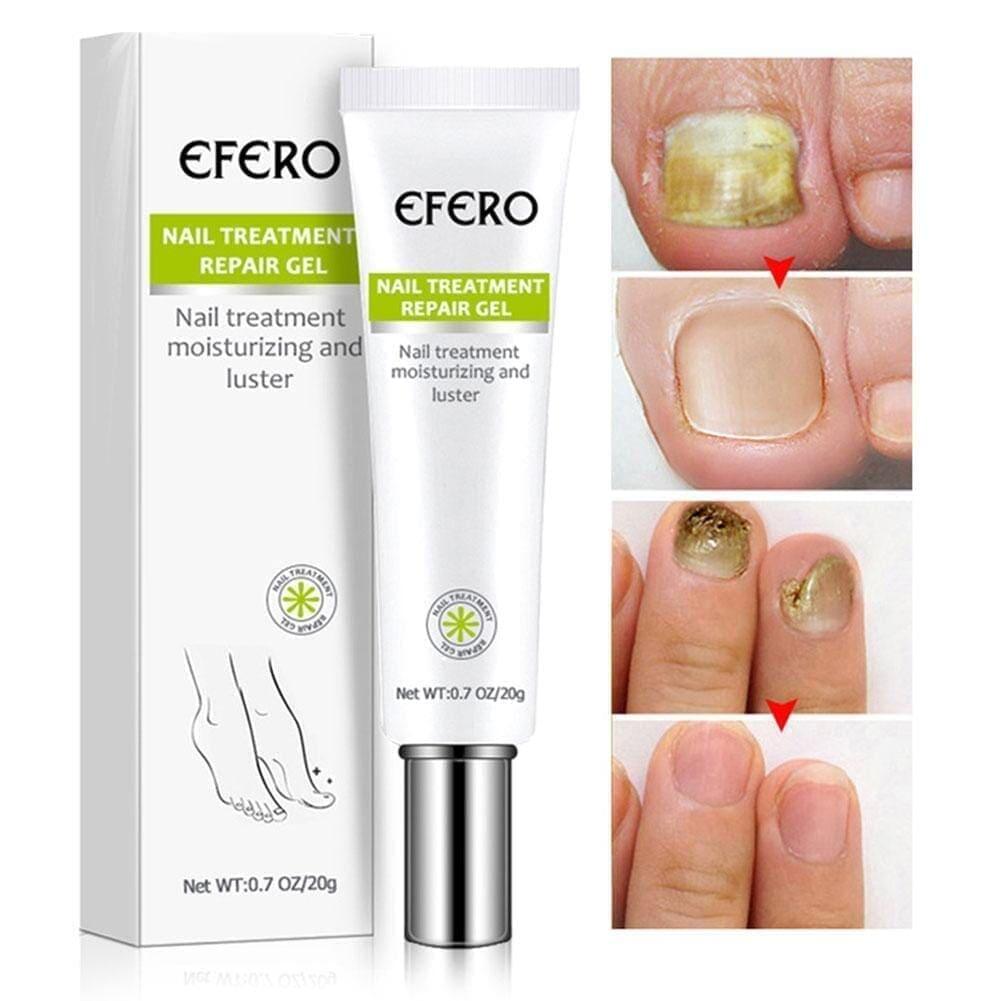 Efero Nails - Gel Anti Fungos e Micoses - Compre 1 Leve 3 + Frete Grátis - Brasil Fast Buy