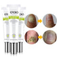 Efero Nails - Gel Anti Fungos e Micoses - Compre 1 Leve 3 + Frete Grátis - Brasil Fast Buy